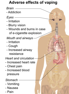What is popcorn lung?